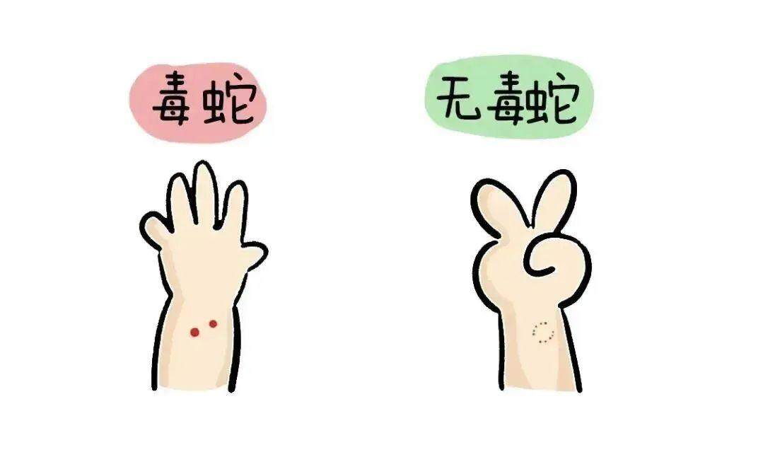 毒蛇的咬痕一般表现为1—4个出血点，多数情况为2个；无毒蛇为两排细小牙痕。图源：青岛卫生健康